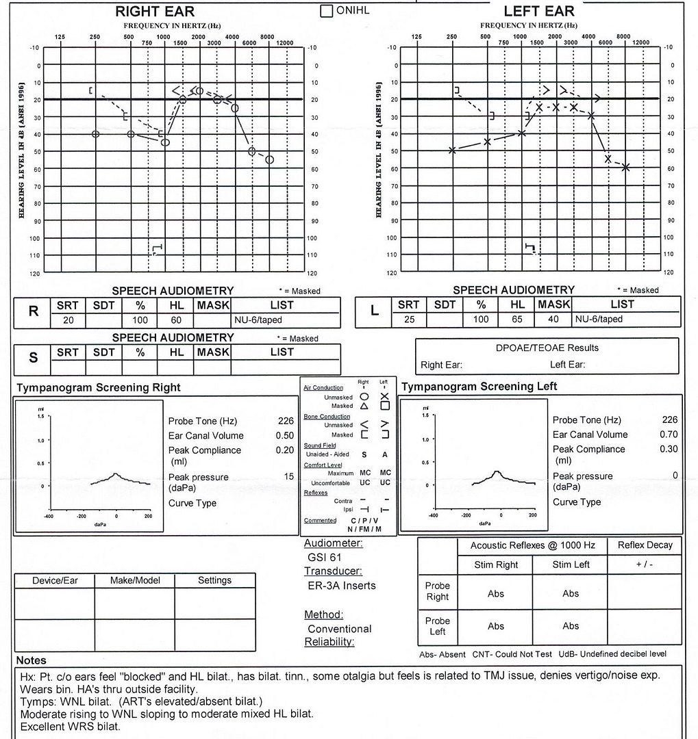 Two different results on audiograms, should I get a third? Hearing